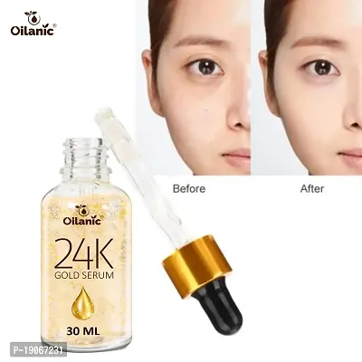 Oilanic 24K Gold Serum for Face Perfect for Dry Skin|Reduce Acne, Dark Spots  Marks Pack of 3 of 30ML-thumb5