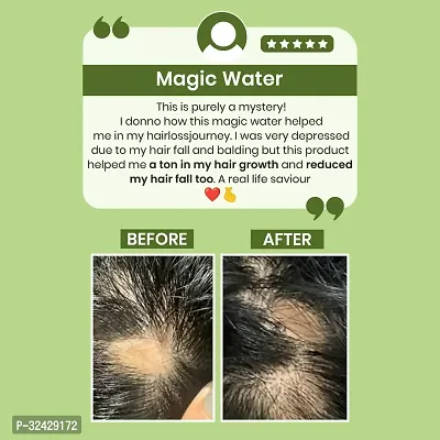 Natural Rosemary Water Spray for Hair Growth 100 Ml Pack of 1-thumb3