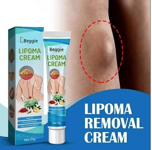 Fozzby 20g Lipoma Removal Cream Mild Easy to Use Care Cream Wide Applaications | Mild  Comfortable | Herbal Remedies  Resins