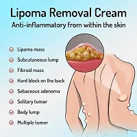 Fozzby 20g Lipoma Removal Cream Mild Easy to Use Care Cream Wide Applaications | Mild  Comfortable | Herbal Remedies  Resins-thumb2