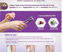 Mederma advance plus is formulated with cepalin  Pack of - 1-thumb2