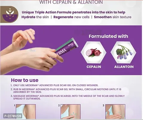 Mederma Advanced Plus Scar Gel, Purple THERE ARE 4 TYPE OF ACNE SCARS-thumb4