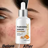 Natural Skin Care Turmeric Face Serum (30 ml)-thumb1