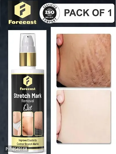 Forecast Present Repair Stretch Marks Removal - Natural Heal Pregnancy Breast, Hip, Legs, Mark Oil 100 Ml Pack Of 1