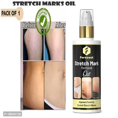 Forecast Present Repair Stretch Marks Removal - Natural Heal Pregnancy Breast, Hip, Legs, Mark Oil 100 Ml Pack Of 1