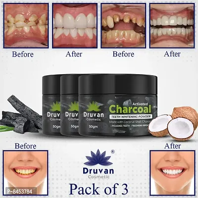 Activated Teeth Whitening Charcoal Powder   For Tobacco Stain  Tartar  Gutkha Stain and Yellow Teeth Removal   No Side Effect   50 gm  Pack of 3