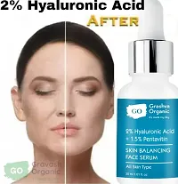 KALP ENTERPRISE 2% Hyaluronic Acid Serum, Instant Hydration For Plump  Bouncy Skin, Daily Use Face Serum, For All Skin Types, Transparent, 30ml-thumb1