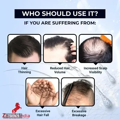 Zenius Hair O Care Capsule for hair growth capsules | hair fall treatment  (60 Capsules)-thumb4