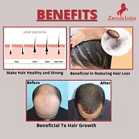Zenius Hair O Care Capsule for hair growth capsules | hair fall treatment  (60 Capsules)-thumb2