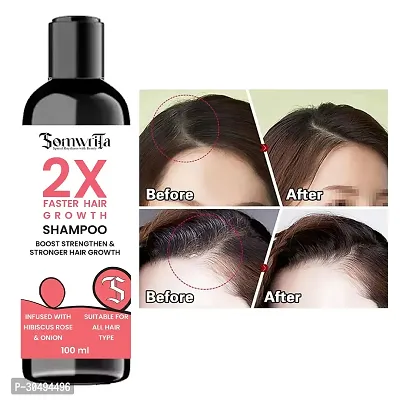 Faster Hair Growth With Hibiscus, Rose, And Onion Shampoo-thumb2