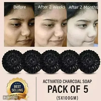 Charcoal Soap For Women Skin Whitening Acne Blackheads Anti Wrinkle Pimple Skin Care Soap Pack Of 5 5 X1 00 G