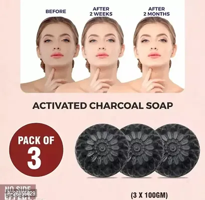 Natural Handmade Charcoal Soap For Women Skin Whitening Acne Pack Of 3, 100 G