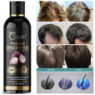 TILLARI Black premium Onion OIL Hair Oil for Hair Growth and Hair Fall Control - 100ml (pack of 1)