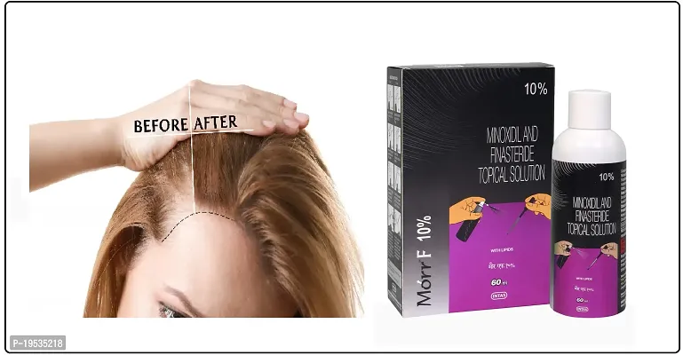 minoxidil morr f 10%