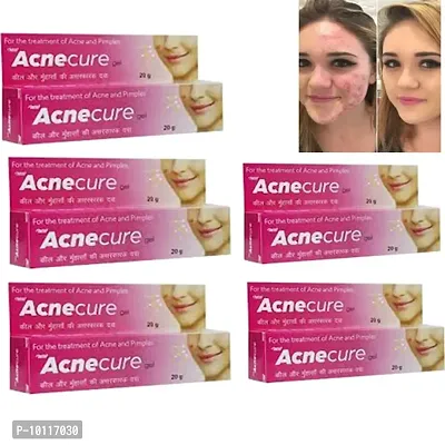 5 Acnecure for the treatment of acne and pimples 20gm(Pack of 5)-thumb0