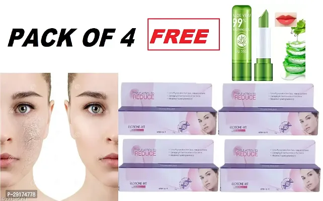 ELOSONE HT 25 gm GM FACE TREATMENT FOR GLOWING SKIN CREAM For Men  women Free Aloe Vera lip Balm ( Pack of 4)