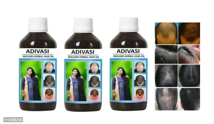 Pack Of 3 100%  Ayurvedic Adivasi Herbal Hair Oil 100 Ml-thumb0