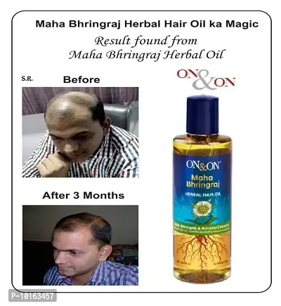 get faster hair growth on and on maha bringha hair oil 200ml-thumb0