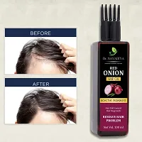 Red Onion Shampoo (300ml.) + Red Onion Hair Growth Oil (100ml.) For Hair Fall Control Combo  (2 Items in the set)-thumb3