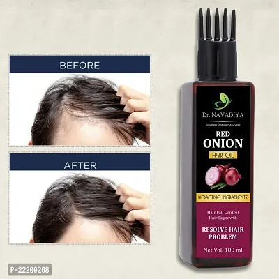 Red Onion Shampoo (300ml.) + Red Onion Hair Growth Oil (100ml.) For Hair Fall Control Combo  (2 Items in the set)-thumb4