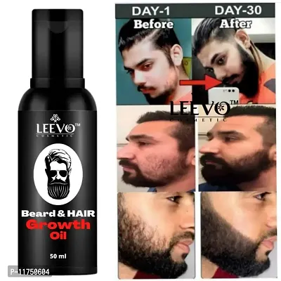Leevo Beard Oil for Fastest Beard Growth | Mooch Oil | Beard Oil | Mooch tale | Dadi tale | Best Beard Oil of India | Daddi ka Tale | Best Beard Oil | Best Beard Oil of India | | Beard Booster | Best