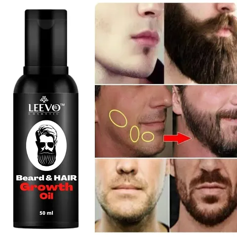 Best Selling All Type Skin Beard Oil