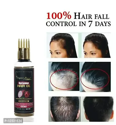 ONION HERBAL HAIR OILPrevents Hair Breakage-thumb0