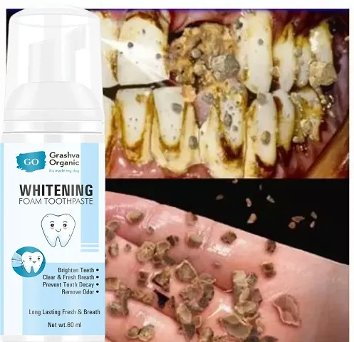 Teeth Whitening Foam Toothpaste Makes You Reveal Perfect  White Teeth, Natural Whitening Foam Toothpaste Mousse with Fluoride Deeply Clean Gums Remove Stains-60ml