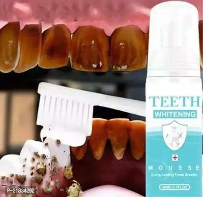 Chamkalo Teeth Whitening Foam Toothpaste Makes You Reveal Perfect  White Teeth, Natural Whitening Foam Toothpaste Mousse with Fluoride Deeply Clean Gums Remove Stains