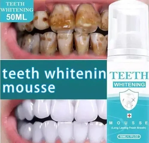 HKT Teeth Whitening Foam Toothpaste Makes You Reveal Perfect  White Teeth, Natural Whitening Foam Toothpaste Mousse with Fluoride Deeply Clean Gums Remove Stains