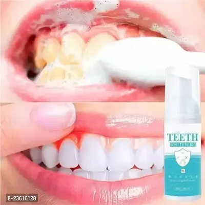 HYK Teeth Whitening Foam Toothpaste Makes You Reveal Perfect  White Teeth, Natural Whitening Foam
