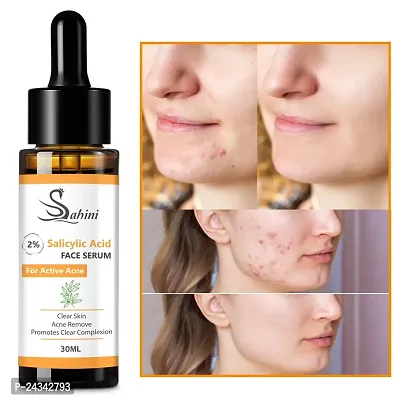sahini 2% salicylic face serum for active acne clear skin acne remove promotes clear complexion 30ml pack-1