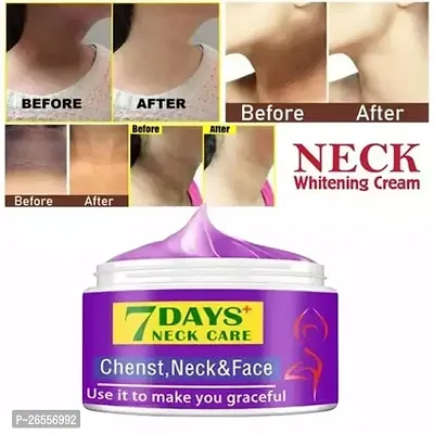 Whitening Cream For Private Parts To Remove Melanin Underarm-Elbow-Neck-Private Part Whitening Cream To Remove Melani For Men  Women (50gm) Pack of 1