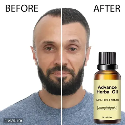 Advance Herbal Oil 100% Pure Natural Increase Thickness For Long Lasting Effect 30ml