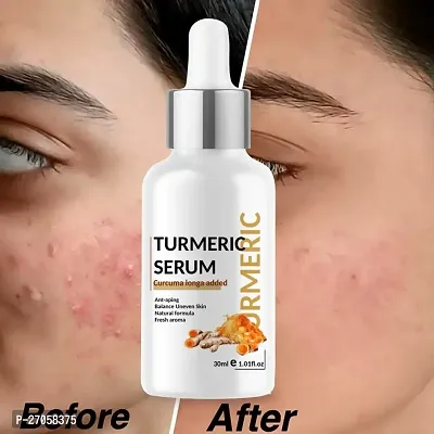 Heny Turmeric Face Serum for Acne, Dark Spots, and Anti-Aging - Suitable for All Skin Types - Glowing and Hydrating Formula