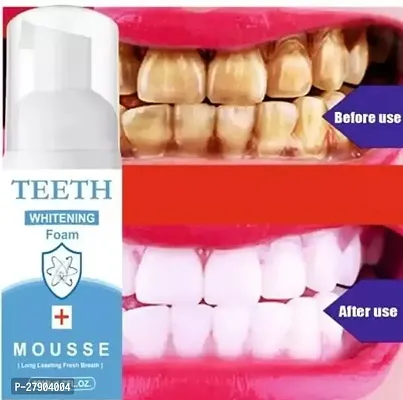 Teeth Whitening Foam Natural Ingredients Baking Soda for Cleaning Teeth and Improve Teeth Health-thumb0