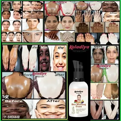 KOLADIYA THE SKIN CARE Skin Whitening  Brightening Nourishing Night Cream for men and women  (30 g).