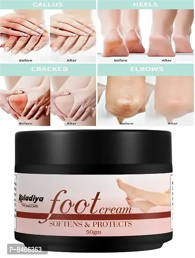 koladiya the skin care Crack Cream for Dry Sirked Hills  Feet (50gm, set of 1)-thumb0