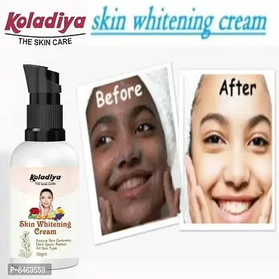 KOLADIYA THE SKIN CARE Skin Whitening  Brightening Nourishing Night Cream for men and women  (30 g).-thumb0