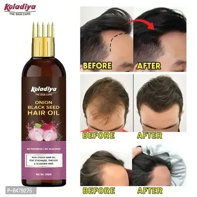 KOLADIYA THE SKIN CARE Onion Hair Oil for Hair Regrowth  Hair Fall Control Hair Oil  (100 ml).