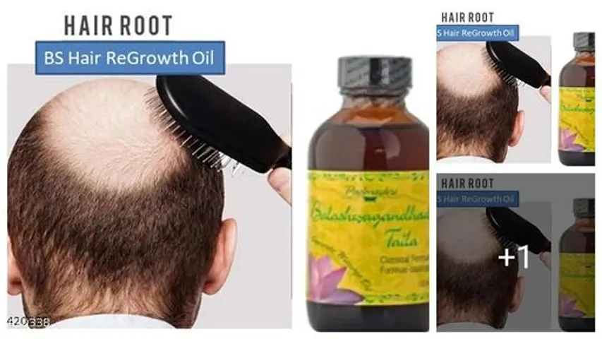 Best Selling Hair Re-Growth Oil