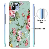 Mi 11 Lite Back Cover Designer Printed Soft Case-thumb1