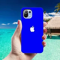 Mi 11 Lite Back Cover Designer Printed Soft Case-thumb3