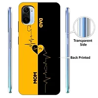 Mi 11X Back Cover Designer Printed Soft Case-thumb1