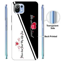 Mi 11 Lite Back Cover Designer Printed Soft Case-thumb1