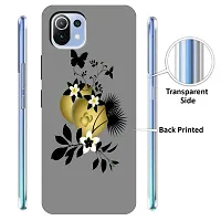 Mi 11 Lite Back Cover Designer Printed Soft Case-thumb1