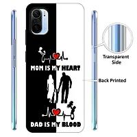 Mi 11X Back Cover Designer Printed Soft Case-thumb1