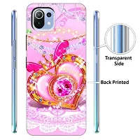 Mi 11 Lite Back Cover Designer Printed Soft Case-thumb1