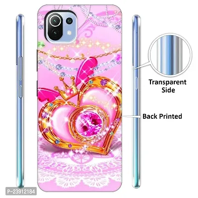 Mi 11 Lite Back Cover Designer Printed Soft Case-thumb2