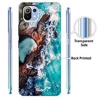 Mi 11 Lite Back Cover Designer Printed Soft Case-thumb1